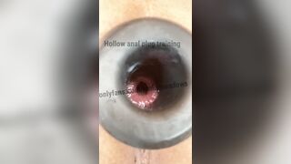 Hollow plug training close up