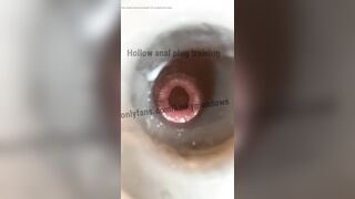 Hollow plug training close up