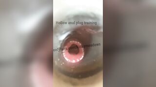 Hollow plug training close up