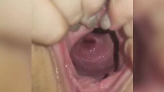 Wide open pussy and cervix show